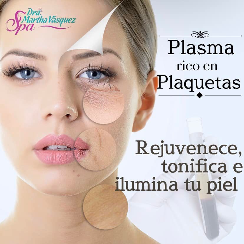 plaquetas